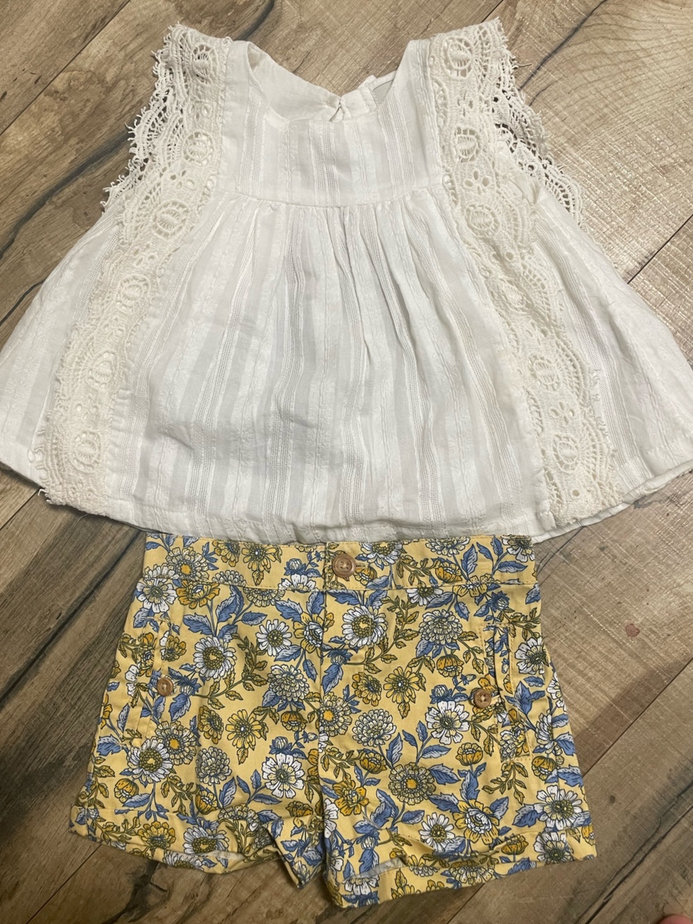 Joie Yellow Floral Cotton Skort with White Lace-Trim Top